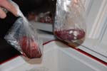 heartkidney